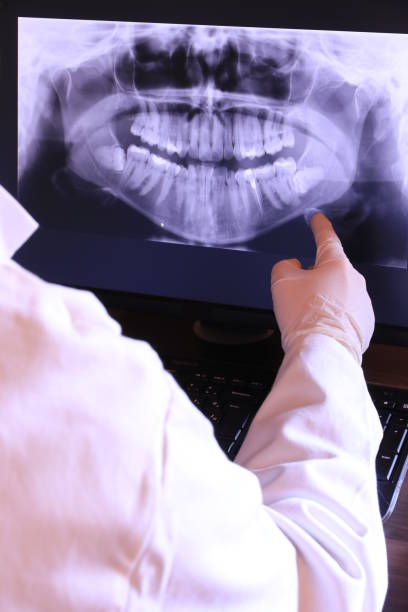 Best Emergency Root Canal Treatment in Bayou Lourse, LA
